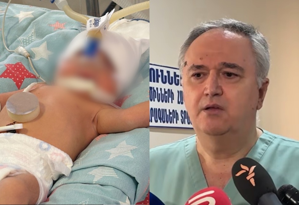 Найденной в Ереване новорожденной девочке было всего 3–6 часов от роду, она родилась вне больницы — врач